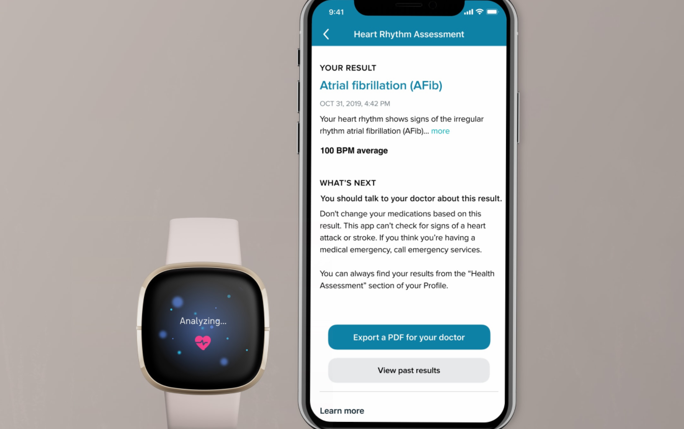 fitbit sense ecg app